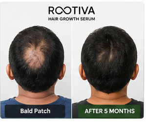 Rootiva before and after result