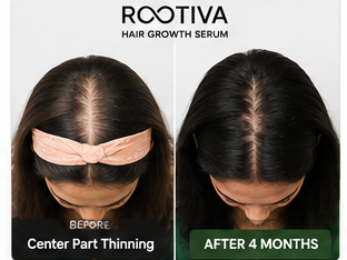 Rootiva before and after result