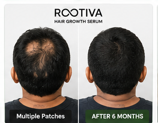 Rootiva before and after result